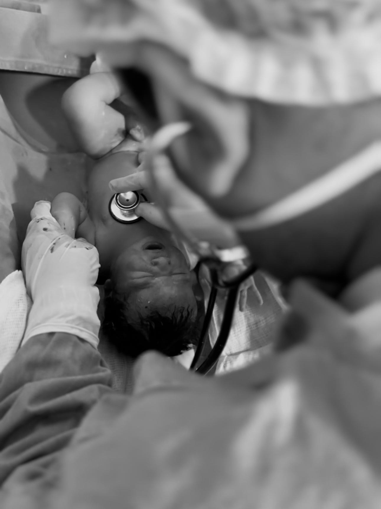 Foto de um medico medindo os sinais vitais de um recem nascido